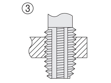 Keylocking Inserts (KIC): Related image